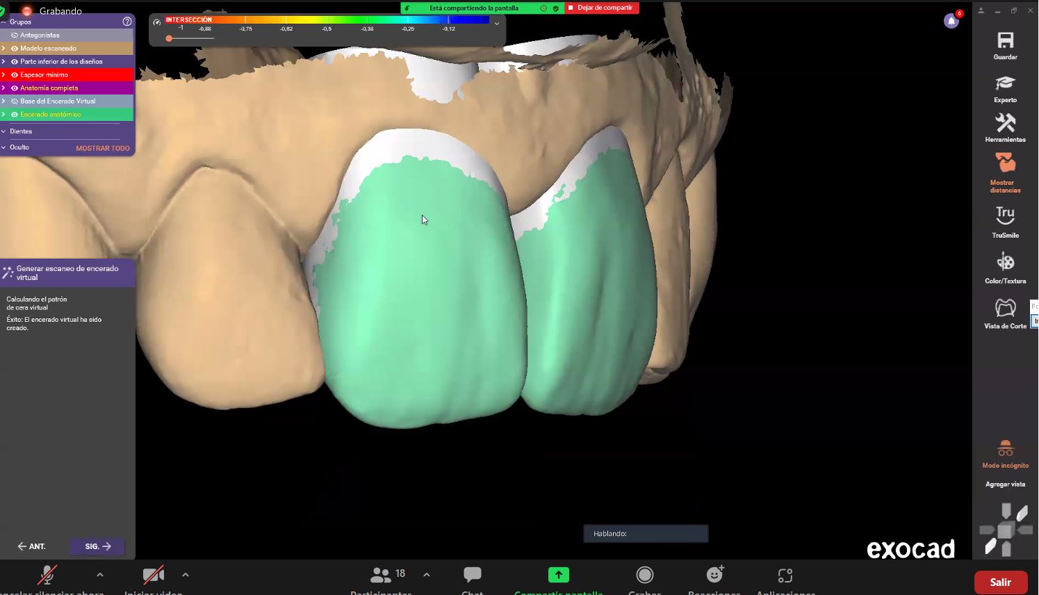 Comienza Un Nuevo Ciclo De Cursos Cad Cam Exocad Para Colegiados